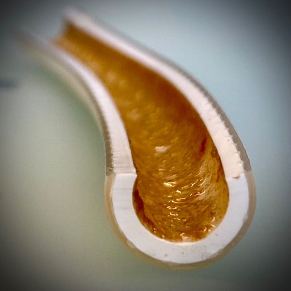 Biofilm in Duschschläuchen: Komplexe mikrobielle Gemeinschaften …